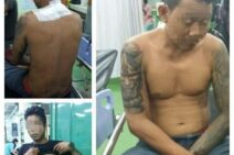 Sempat Kritis, Salah Satu Korban Penebasan Meninggal di RS Sanglah