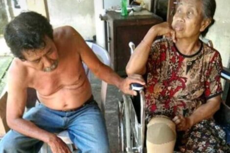 Dapat Bantuan Kursi Roda dan Kaki Palsu Ibu Wayan Jati Bisa Kembali Beraktivitas