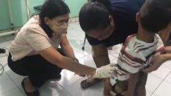 Stunting Buleleng Tercatat 3,47 Persen, Dinkes Perkuat Pemantauan Balita
